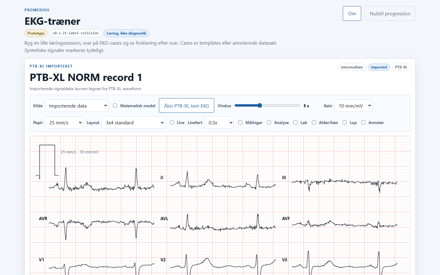 Screenshot af EKG-træner